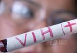 В Иркутской области зарегистрировано 28 тысяч вич-инфицированных В Иркутской области зарегистрировано 28 тысяч вич-инфицированных
